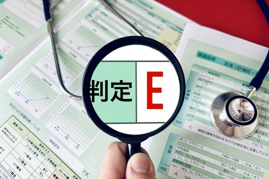 E判定からの逆転合格を実現する戦略的勉強法｜二次試験・個別試験で偏差値を底上げし志望校を勝ち取るための全工程