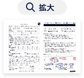 拡大