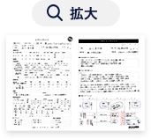 拡大